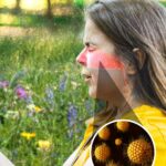 Seasonal Allergies: Symptoms, Causes and Treatment